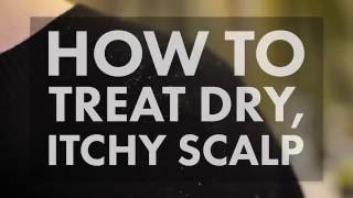 How to Treat a Dry Itchy Scalp  WebMD [upl. by Trautman]