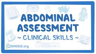 Abdominal Assessment Clinical Skills [upl. by Drusie222]