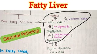 Fatty Liver  Steatosis of Liver  Fatty Change in Liver  General Pathology [upl. by Wylma]