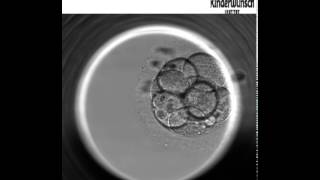 Die Embryo Entwicklung bis zur Blastozyste  Embryoskop [upl. by Mich]