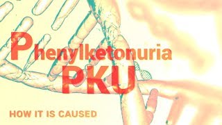 Phenylketonuria  PKU  Mental Retardation  Phenylalanine Hydroxylase [upl. by Eusassilem]