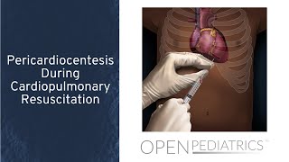 Pericardiocentesis During Cardiopulmonary Resuscitation by T Wolbrink  OPENPediatrics [upl. by Krasnoff702]