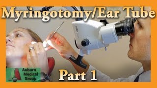 How to STOP Itchy Ear Canals  Ear Itch Relief [upl. by Elhsa885]