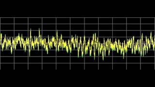 Ascaris Parasite also Ascariasis  Rife Frequencies [upl. by Ahsea192]