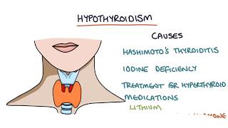 Hypothyroidism and Hashimotos Thyroiditis Visual Explanation for Students [upl. by Ettigdirb]