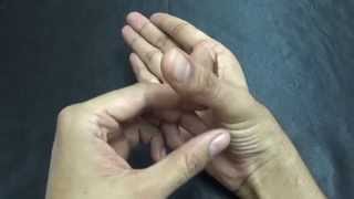 1st CARPOMETACARPAL JOINT  MOVEMENTS [upl. by Eltsirc]