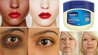 Top 3 Ways To Use Vaseline  Get Fair amp Glowing Skin  Removes Dark Spot Aging Signs amp Dark Circles [upl. by Gus]