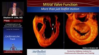 Mitral Stenosis Stephen H Little MD Sunday August 21 2016 [upl. by Paxon]