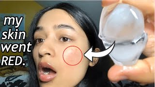 I rubbed ICE CUBES on my face everyday for 7 days  this is what it did to my skin [upl. by Acirred]