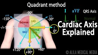 Cardiac Axis Interpretation Animation [upl. by Ivette]