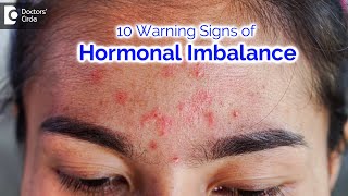 10 warning signs of hormonal imbalance causing Skin Problems  Dr Nischal K  Doctors Circle [upl. by Riedel]