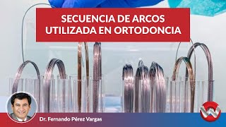 Secuencia de Arcos Utilizada en Ortodoncia [upl. by Grange]