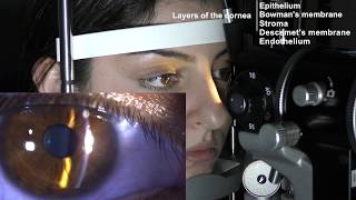 Ophthalmic Skills Series Part 15 [upl. by Grindle]