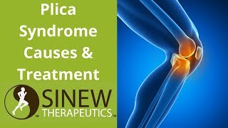 Plica Syndrome Causes and Treatment [upl. by Iggy210]